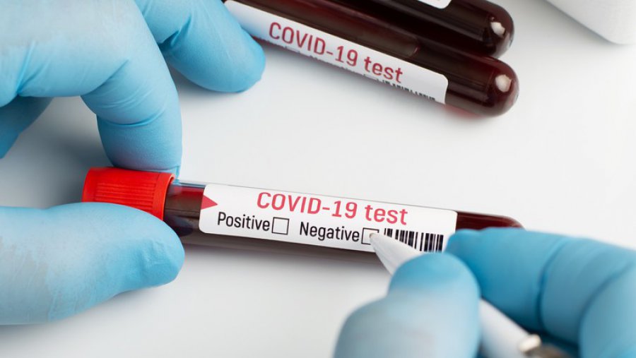 Co 60. test na koronawirusa dał wynik pozytywny